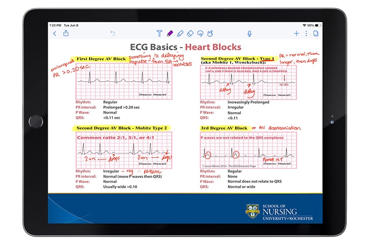 iPad with ECG Basics graphs and notes
